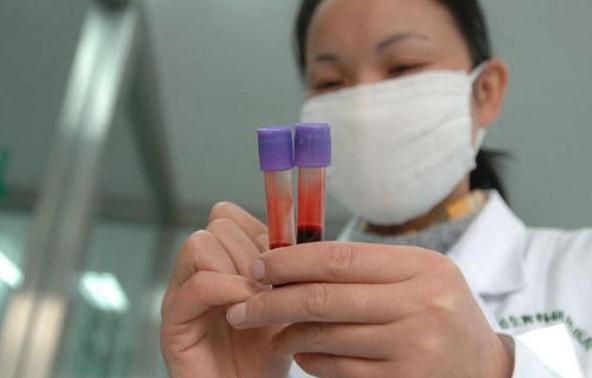 血清测试实验，探索生命科学的奥秘