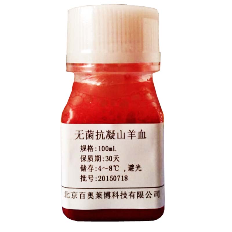 羊抗人IgG抗血清，一种重要的医学与生物学研究工具