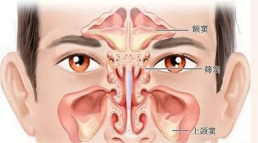 鼻子疼怎么回事，探究病因与应对之策