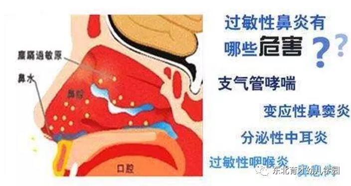 鼻子流黄水的原因及其解析