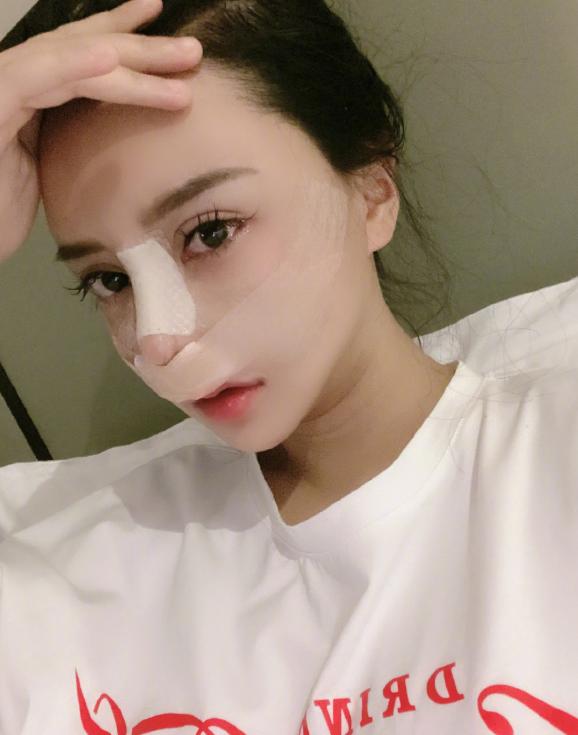 探索没有鼻尖的鼻子图片，美学、艺术还是医学议题？