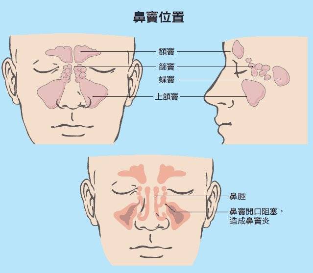 鼻子总流清水鼻涕，原因、影响与应对方法
