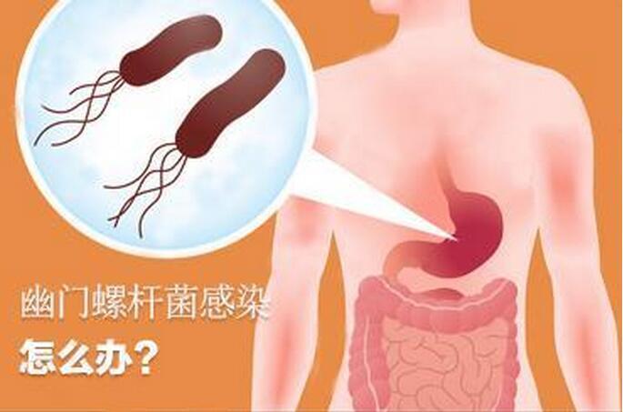 杆菌的种类，多样性与重要性