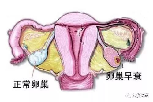 关于取卵后腹痛的处理方法